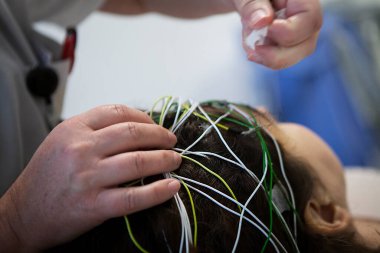 Neurology: screening and monitoring of epilepsy, placement of electrodes for EEG or electroencephalogram.