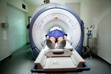 MRI or magnetic resonance imaging of a patient's head.