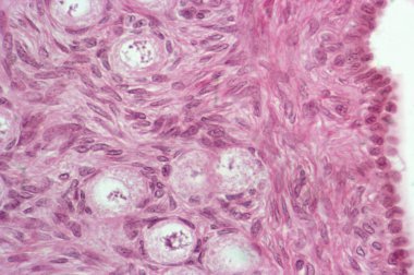 Primary follicle. abstract background