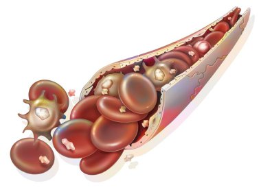 Composition of the blood (blood capillary): red blood cells, white blood cells. . clipart
