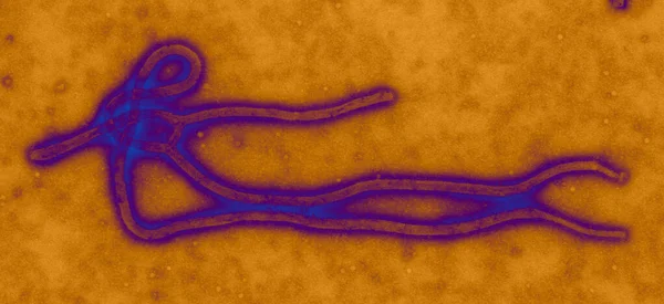 Ebola Virus Viewed Tem Ebola Virus Rna Virus Responsible Severe — Stockfoto