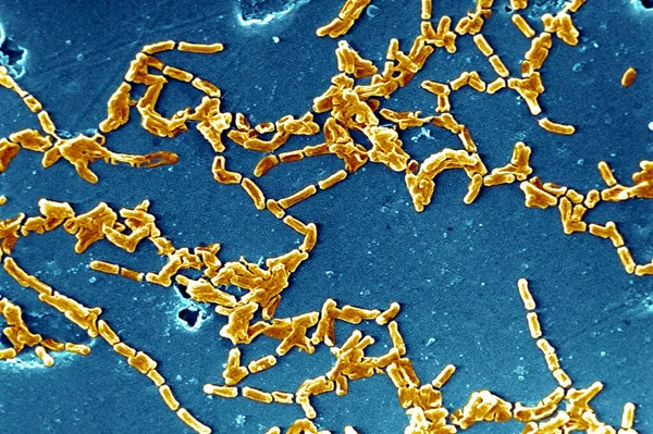 Elektron Test Mycobacterium Chelonae Bir Tarama — Stok fotoğraf