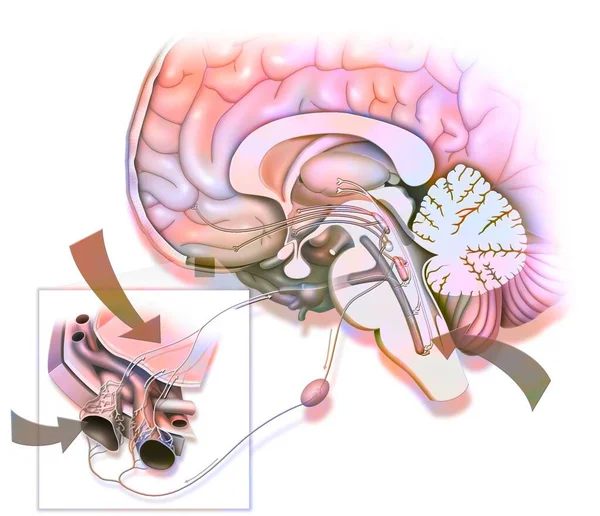 Migraine Said Caused Stimulation Trigeminal Nerve — Foto Stock
