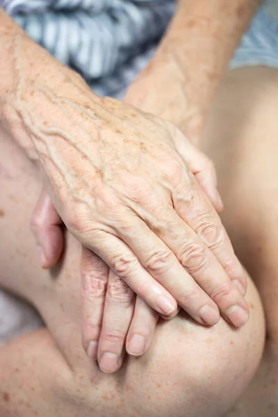 Hands Spots Old Age — Fotografia de Stock