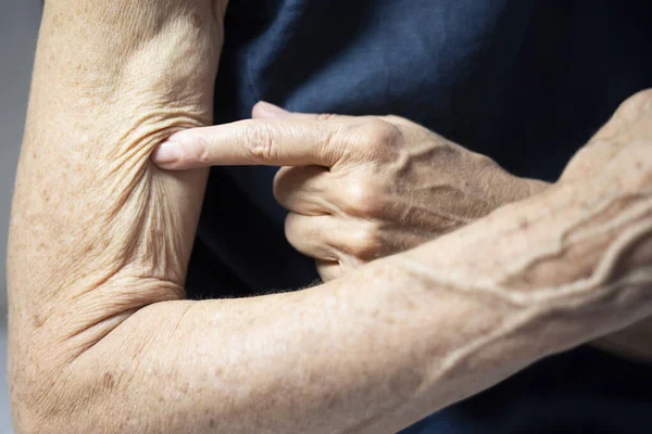 Arm Old Woman —  Fotos de Stock