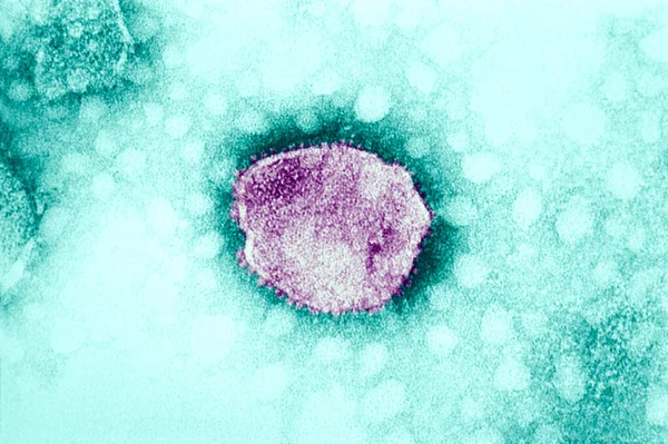 Tacaribe Complex New World Arenaviruses Electron Micrograph Arenaviridae Arenaviridae Rna — Foto Stock