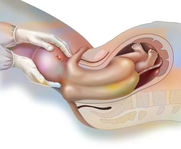 Childbirth Step Release Other Shoulder Midwife — Zdjęcie stockowe