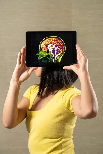 Woman holding screen with cut of brain