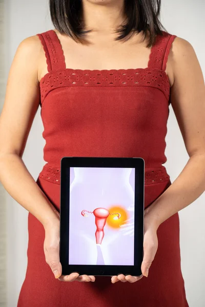 Woman Holding Screen Ovarian Fibroma — 스톡 사진