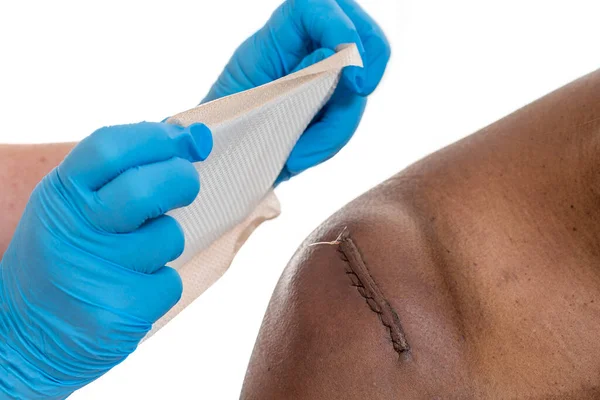 Sticking Plaster Applied Awound Sitched Scar — Stock Photo, Image