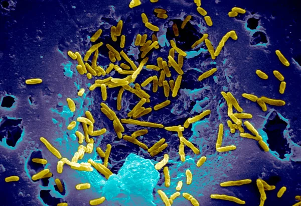 Skenování Electron Mikrofotografie Mycobacterium Chelonae — Stock fotografie