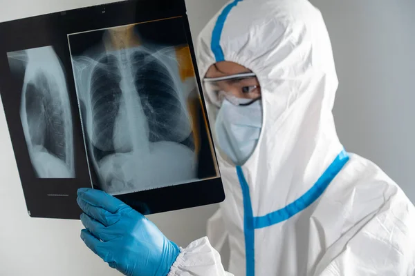 Doctor Covid Ward Hospital Examining Rays Lungs — Stockfoto