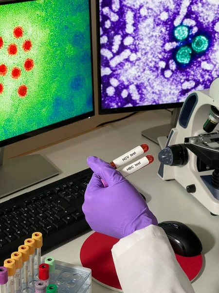 Laboratory Assistant Doing Research Images Hepatitis Virus Computer — Foto Stock