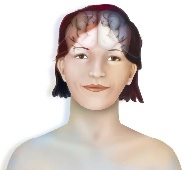 Мозг Правое Левое Полушарие Головного Мозга Лице Женщины — стоковое фото