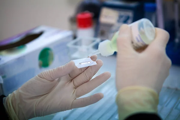 Manufacture Therapeutic Vaccines Treatment Small Cell Lung Cancer — Fotografia de Stock