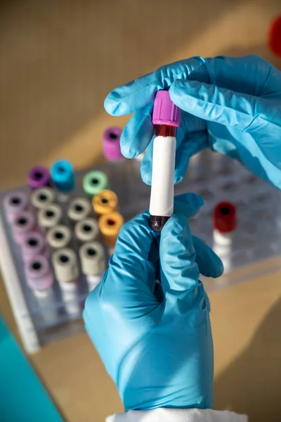 Laboratory Technician Performing Blood Tests Laboratory — Foto Stock