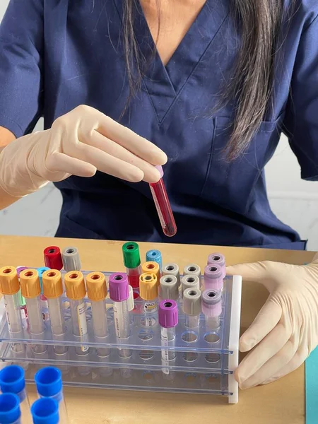 Serological Test Done Blood Test Look Presence Antibodies Virus — Stok fotoğraf