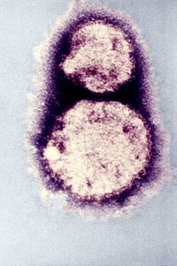 Hantavirus, the causal agent of hantavirus pulmonary syndrome (HPS).