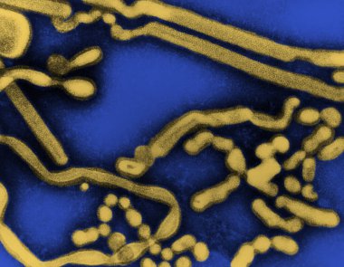 Transmission electron micrograph of influenza A virus, early passage. The swine influenza virus as all Influenza A virus, is a pleomorphic virus, which means that it can adopt different shapes according to the conditions. The virus of influenza can a