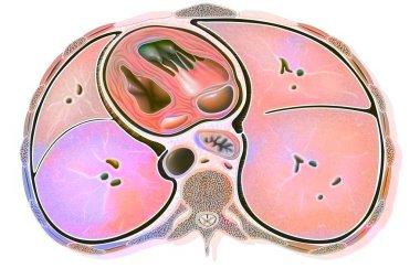 Cross section of the thorax with the heart, lungs, esophagus and aorta.