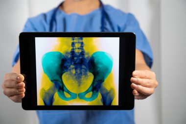 Female doctor holding a screen with x-ray of the pelvis
