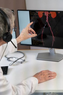 Cardiologist during a video consultation with a colleague for a phlebitis diagnosis.