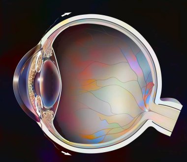 Normal eye with iridocorneal angle showing retina, lens. .