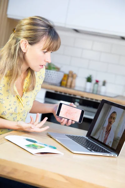 Video Consultation Young Woman Her Heat Rash She Has Taken — Stockfoto