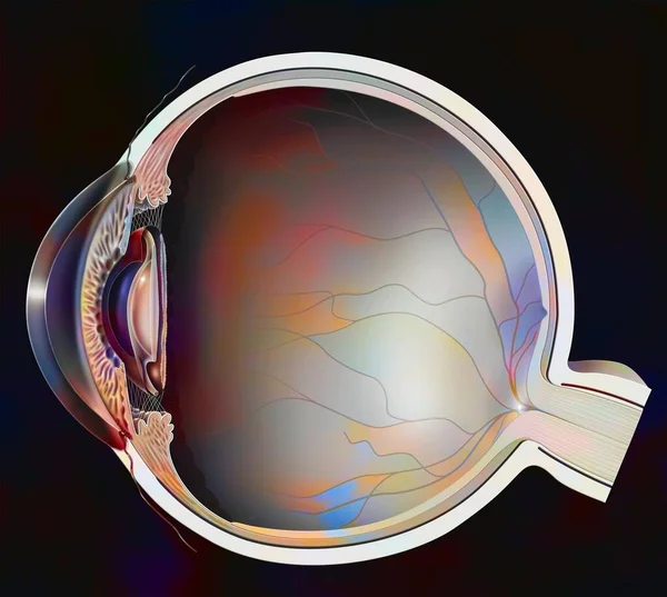 Eye Secondary Cataract Clouding Posterior Lens Capsule — Stockfoto