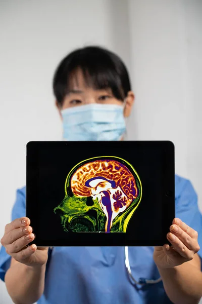 Woman Holding Screen Brain Image — Foto Stock