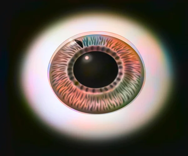 Глаукома Райдужка Одного Ока Щоб Показати Процедуру Лазерної Іридектомії — стокове фото