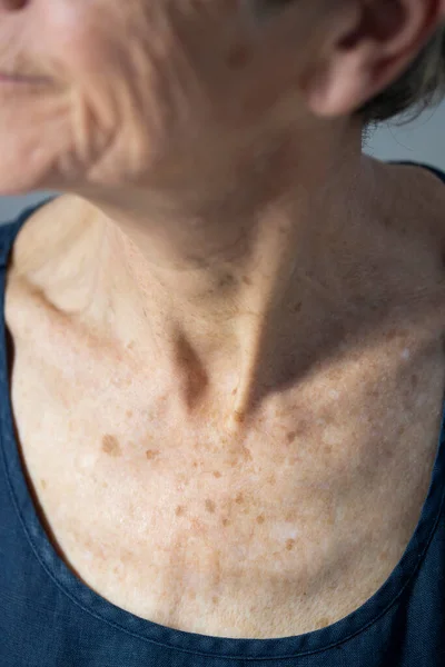 Chest Old Woman — Stock Photo, Image