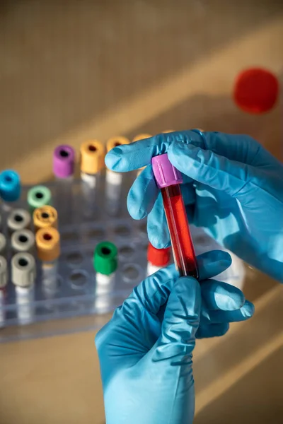 Laboratory Technician Performing Blood Tests Laboratory — Photo