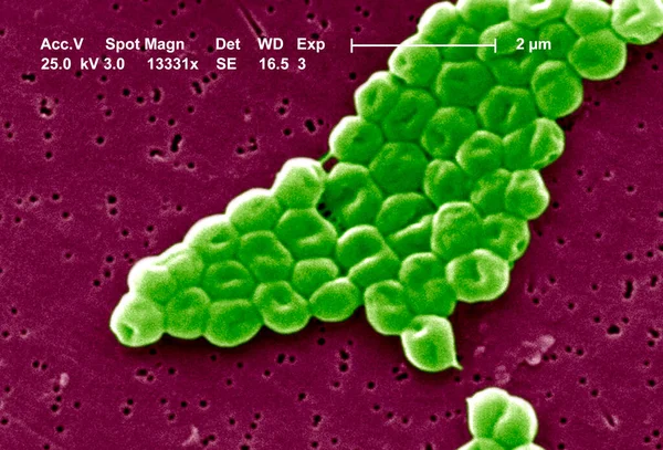 Sem Depicts Highly Magnified Cluster Gram Negative Non Motile Acinetobacter — Stock Photo, Image