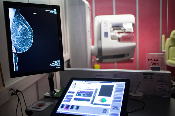 Mammogram in a radiology department of a hospital.