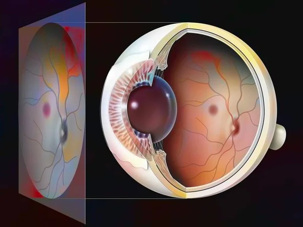 Eye Glaucoma Examination Fundus Result — Foto Stock