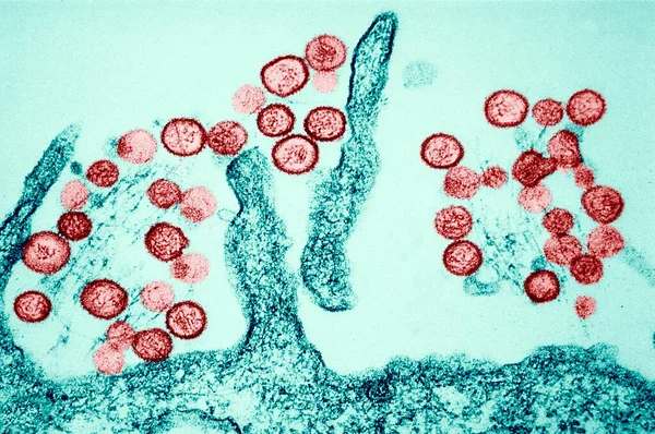 Transmission Electron Micrograph Sin Nombre Hanta Virus Hantaviruses Cause Hantavirus — Stock Photo, Image