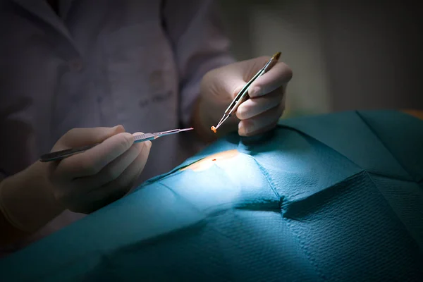 Dermatologist Removes Suspicious Mole — 图库照片