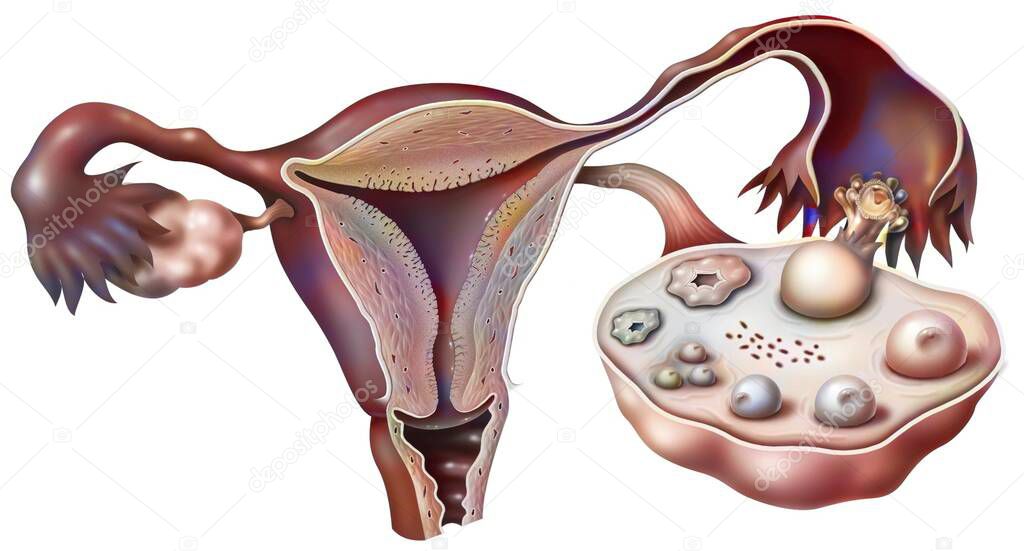 Internal female genitalia in 3/4 anterior view.