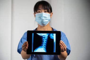 Female doctor holding a screen with x-ray of cervical vertebrae
