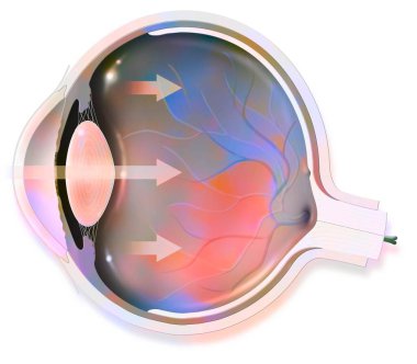 Anatomy of the eye whose arrows represent light and revealing the lens, retina, cornea, iris, choroid. .