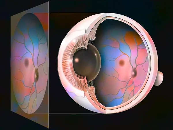 Eye Glaucoma Examination Fundus Result — Zdjęcie stockowe