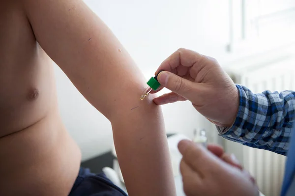 Pulmonologist Αλλεργιολόγος Εκτελεί Δερματικές Αλλεργικές Δοκιμές Ένα Νεαρό Ασθματικό — Φωτογραφία Αρχείου