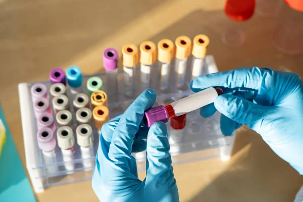 Laboratory Technician Performing Blood Tests Laboratory — Photo