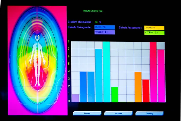 Chromotherapy is carried out in the form of a cure which first tests the colors to be used for each one.