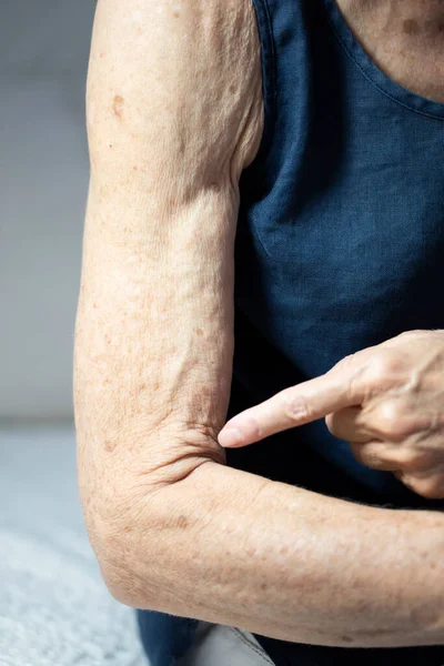 Arm Old Woman —  Fotos de Stock