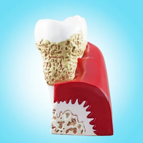 Fogak, fogászati szakasz modell. — Stock Fotó