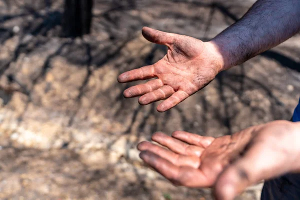 Hands of a firefighter man in the forest fire, burned forest, climate change