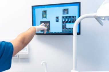 Diş kliniği, röntgene bakan genç bir kadının rutin tıbbi muayenesi.