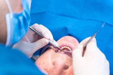 Diş kliniği, yaşlı bir kadının dişlerini kontrol eden bir doktorun elleri.